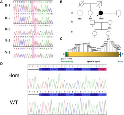 Case Report: Late-Onset Autosomal Recessive Cerebellar Ataxia Associated With SYNE1 Mutation in a Chinese Family